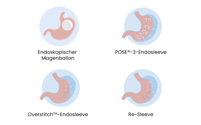 Grafik mit Icons, die verschiedene bei S-thetic Weight angebotene medizinische Methoden zur Gewichtsabnahme erklären.
